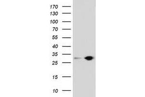 Western Blotting (WB) image for anti-Sepiapterin Reductase (SPR) antibody (ABIN1501114) (SPR 抗体)