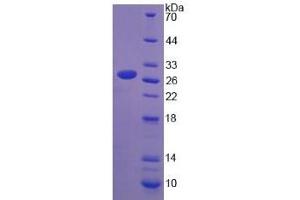 Image no. 1 for Lymphocyte Cytosolic Protein 1 (LCP1) (AA 5-233) protein (His tag) (ABIN6236891)