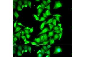 Immunofluorescence analysis of HeLa cells using PPM1A Polyclonal Antibody (PPM1A 抗体)