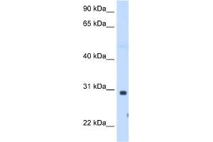 WB Suggested Anti-ST3GAL3 Antibody Titration:  1. (ST3GAL3 抗体  (C-Term))