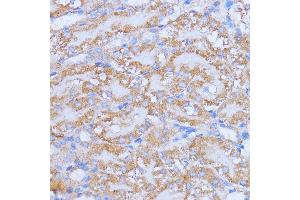 Immunohistochemistry (IHC) image for anti-NME/NM23 Nucleoside Diphosphate Kinase 6 (NME6) (AA 9-194) antibody (ABIN7268942)