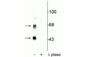 Western blot of rat brain lysate showing specific immunolabeling of the ~50 kDa α- and the ~60 kDa β-CaM Kinase II phosphorylated at Thr306 in the first lane (-). (CaMKII alpha/beta (pThr306) 抗体)
