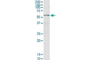 CHEK2 MaxPab rabbit polyclonal antibody. (CHEK2 抗体  (AA 1-543))