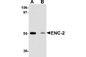 Western Blotting (WB) image for anti-Kelch-Like 25 (KLHL25) (Middle Region) antibody (ABIN1030925)
