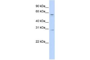 Western Blotting (WB) image for anti-REC8 Homolog (Yeast) (REC8) antibody (ABIN2459159) (REC8 抗体)