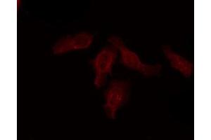 ABIN6274488 staining COLO205 by IF/ICC. (ATF6B 抗体  (Internal Region))