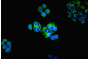 Immunofluorescent analysis of PC-3 cells using ABIN7142622 at dilution of 1:100 and Alexa Fluor 488-congugated AffiniPure Goat Anti-Rabbit IgG(H+L) (HTR2A 抗体  (AA 385-471))