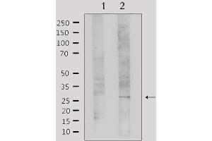 Western blot analysis of extracts from Hela, using Galectin 3 Antibody. (Galectin 3 抗体  (Internal Region))