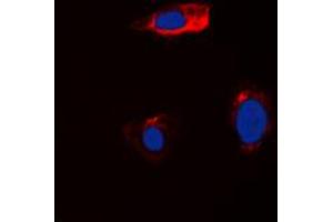 Immunofluorescent analysis of Cystatin 11 staining in HEK293T cells. (CST11 抗体  (Center))