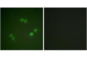 Immunofluorescence analysis of A549 cells, using SF1 (Phospho-Ser82) Antibody. (Splicing Factor 1 抗体  (pSer82))