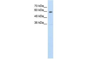 Western Blotting (WB) image for anti-Solute Carrier Family 11 (Proton-Coupled Divalent Metal Ion Transporters), Member 1 (SLC11A1) (C-Term) antibody (ABIN2781545)