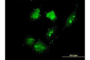 Immunofluorescence of monoclonal antibody to THG-1 on HeLa cell. (TSC22D4 抗体  (AA 1-395))