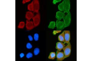 ABIN6262821 and ABIN6272334 staining Hela cells(30 min of UV treatment) by IF/ICC.