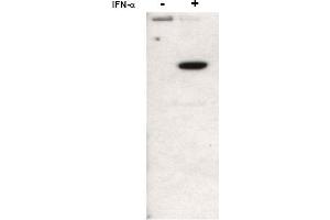 Image no. 1 for anti-Signal Transducer and Activator of Transcription 2, 113kDa (STAT2) (N-Term), (pTyr690) antibody (ABIN401443) (STAT2 抗体  (N-Term, pTyr690))