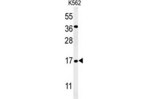 Western Blotting (WB) image for anti-N(alpha)-Acetyltransferase 50, NatE Catalytic Subunit (NAA50) antibody (ABIN3002220) (NAA50 抗体)