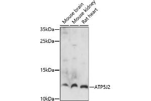 Western blot analysis of extracts of various cell lines, using J2 antibody (ABIN7265725) at 1:1000 dilution. (ATP5J2 抗体)