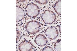 (ABIN6242630 and ABIN6577239) staining SD1 in hun colon tissue sections by Immunohistochemistry (IHC-P - paraforldehyde-fixed, paraffin-embedded sections). (SMAD1 抗体  (AA 20-330))