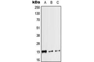 Western blot analysis of Calcitonin expression in HEK293T (A), mouse heart (B), rat heart (C) whole cell lysates. (Calcitonin 抗体  (Center))