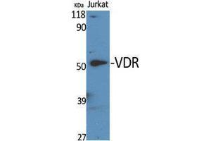Western Blotting (WB) image for anti-Vitamin D Receptor (VDR) (Tyr307) antibody (ABIN3187461) (Vitamin D Receptor 抗体  (Tyr307))