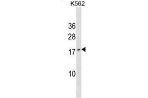 Western Blotting (WB) image for anti-GTP Cyclohydrolase I Feedback Regulator (GCHFR) antibody (ABIN3000608) (GCHFR 抗体)