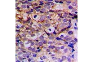 Immunohistochemistry (IHC) image for anti-Presenilin 2 (Alzheimer Disease 4) (PSEN2) antibody (ABIN7308236)