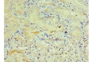 Immunohistochemistry of paraffin-embedded human kidney tissue using ABIN7154113 at dilution of 1:100 (GSTO2 抗体  (AA 124-243))
