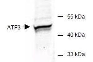 Image no. 2 for anti-Activating Transcription Factor 3 (ATF3) (AA 113-130) antibody (ABIN401262) (ATF3 抗体  (AA 113-130))