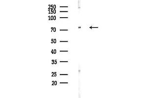 Western blot analysis of lysates from Rat brain, using Phospho-5 Lipoxygenase (Ser523) Antibody at 1/1000 dilution.