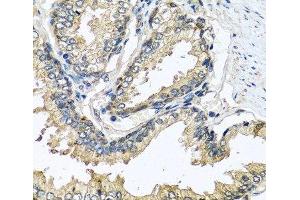 Immunohistochemistry of paraffin-embedded Human prostate using CST1 Polyclonal Antibody at dilution of 1:100 (40x lens). (CST1 抗体)