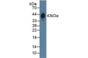 Detection of HPR in Human Serum using Polyclonal Antibody to Haptoglobin Related Protein (HPR) (HPR 抗体  (AA 70-332))
