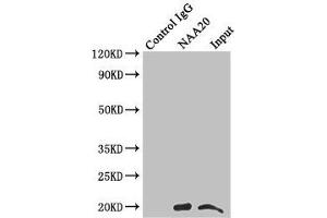 Immunoprecipitating NAA20 in Hela whole cell lysate Lane 1: Rabbit control IgG instead of (1 μg) instead of ABIN7160737 in Hela whole cell lysate. (NAA2 (AA 49-178) 抗体)
