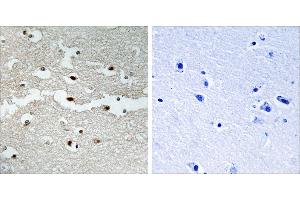 Peptide - +Immunohistochemistry analysis of paraffin-embedded human brain tissue, using BRCA2 antibody. (BRCA2 抗体)