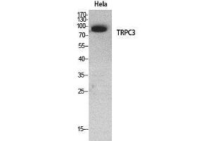 Western Blotting (WB) image for anti-Transient Receptor Potential Cation Channel, Subfamily C, Member 3 (TRPC3) (Internal Region) antibody (ABIN6283972)