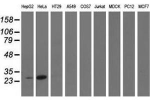 Western blot analysis of extracts (35 µg) from 9 different cell lines by using anti-GSTT2 monoclonal antibody. (GSTT2 抗体)