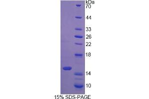 Image no. 1 for S100 Calcium Binding Protein A16 (S100A16) (AA 1-97) protein (His tag) (ABIN6237899) (S100A16 Protein (AA 1-97) (His tag))
