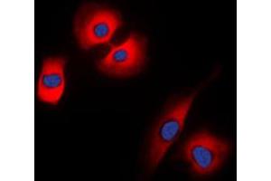 Immunofluorescent analysis of Synaptophysin staining in HeLa cells. (Synaptophysin 抗体  (Center))