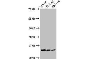 Western Blot Positive WB detected in: Rat liver tissue, Rat kidney tissue, Rat spleen tissue All lanes: CCDC26 antibody at 2. (CCDC26 抗体  (AA 1-109))