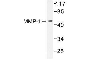 Image no. 1 for anti-Matrix Metallopeptidase 1 (Interstitial Collagenase) (MMP1) antibody (ABIN265522) (MMP1 抗体)