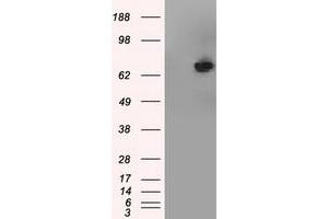 HEK293T cells were transfected with the pCMV6-ENTRY control (Left lane) or pCMV6-ENTRY TTLL12 (Right lane) cDNA for 48 hrs and lysed. (TTLL12 抗体)