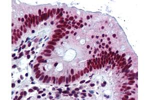 Anti-HNRNPK / hnRNP K antibody IHC of human colon. (HNRNPK 抗体)