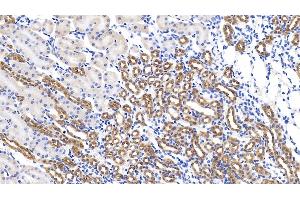 Detection of GPC1 in Mouse Kidney Tissue using Polyclonal Antibody to Glypican 1 (GPC1) (GPC1 抗体  (AA 155-292))