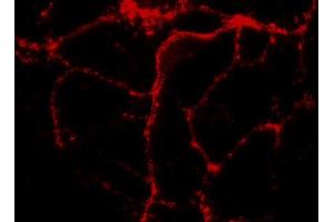 Immunocytochemistry on cultured hippocampus neurons (dilution 1 : 1000). (RAB3A 抗体  (AA 2-14))