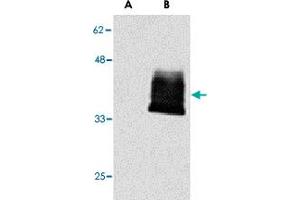 Western blot analysis of TNFRSF12A in (A) mock- and (B) TNFRSF12A-GPI-transfected 293 cells with TNFRSF12A polyclonal antibody  at 1 ug/mL . (TNFRSF12A 抗体)