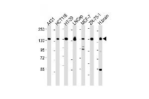 All lanes : Anti-MYO6 Antibody (C-term ) at 1:2000-1:8000 dilution Lane 1: A431 whole cell lysate Lane 2: HC whole cell lysate Lane 3: HT-29 whole cell lysate Lane 4: LNCap whole cell lysate Lane 5: MCF-7 whole cell lysate Lane 6: ZR-75-1 whole cell lysate Lane 7: Human brain lysate Lysates/proteins at 20 μg per lane. (Myosin VI 抗体  (C-Term))