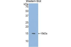 Western blot analysis of the recombinant protein. (GDF6 抗体  (AA 339-454))