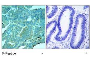 Image no. 1 for anti-Eukaryotic Translation Initiation Factor 2-alpha Kinase 2 (EIF2AK2) (pThr446) antibody (ABIN197048) (EIF2AK2 抗体  (pThr446))