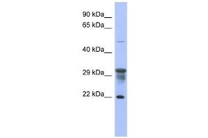 PMM1 antibody used at 1 ug/ml to detect target protein. (PMM1 抗体  (N-Term))