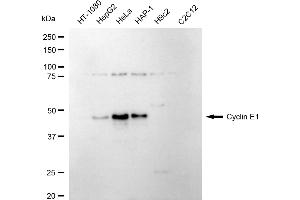 Western blotting analysis using cyclin E1 antibody (ABIN7798197). (Recombinant Cyclin E1 抗体)