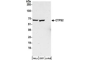 Western Blotting (WB) image for anti-CTP Synthase II (CTPS2) (AA 536-586) antibody (ABIN7449705)