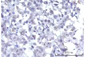 IHC analysis of RBM15B using anti-RBM15B antibody (ABIN7600219). (RBM15B 抗体  (AA 164-890))